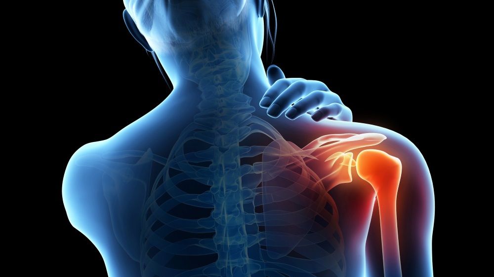 Homeopathic solutions for Athritis Sciatica Knee Joint Pain